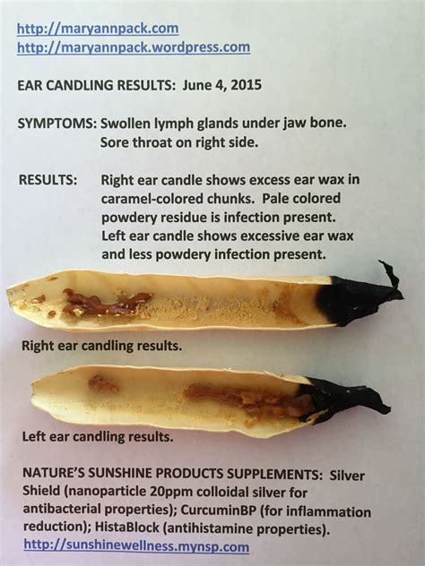 ear candling results pictures